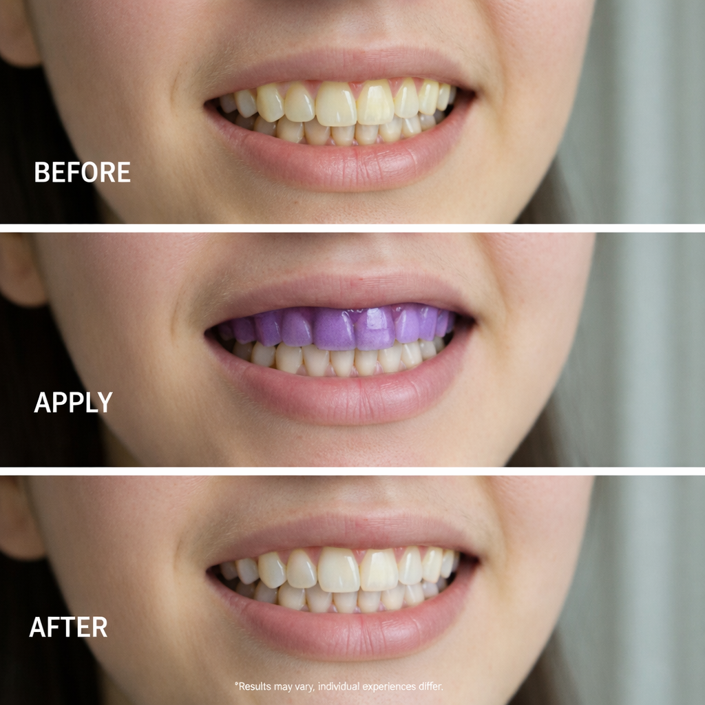 Bloom Teeth™ Whitening Strips
